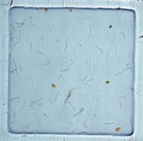 Figura 39 - Imagem das cianobactérias Cylindrospermopsis raciborskii na água da Lagoa do Peri.