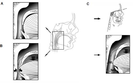 21 Figura 4 - Diagrama mostrando o mecanismo que liga a mudança na postura da língua à mudança na postura crânio-cervical.