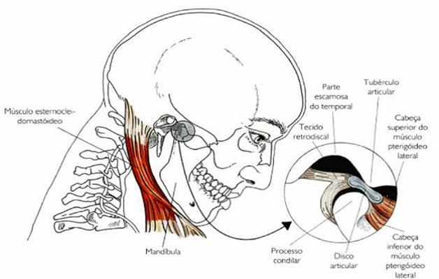 23 Figura 6 - Posição mandibular em anteriorização da cabeça Fonte: BIASOTTO-GONZALEZ, 2005. Para D Attilio et al.