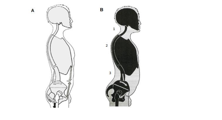 24 Figura 7 - Postura normal (A); exagero das curvaturas da coluna vertebral (B): lordose cervical (1), cifose torácica (2) e lordose lombar (3). Fonte: ARELLANO, 2002.