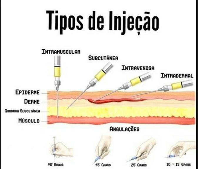 Via Intramuscular: Diferenças Via Intramuscular: Complicações Punção