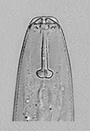 A seta indica a posição mais anterior da vulva nessa espécie que nas demais comumente encontradas no Brasil (barra da escala = 20 µm).