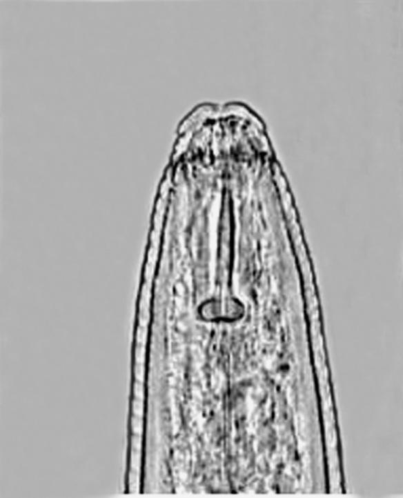 javanica As Figuras 4 e 5 ilustram os principais caracteres morfológicos que identificam as subpopulações das espécies de Meloidogyne incognita e M.