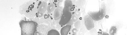 Occurrence and significance of ovarian marked structural