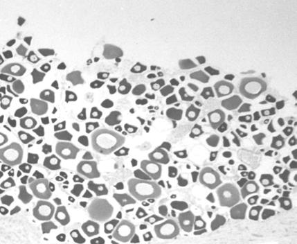 (thin arrow), and some oocytes at perinucleolar stage (fat