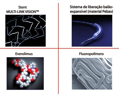 A seguir, discutiremos com brevidade os elementos que compõem o stent Xience V e apresentaremos os resultados dos principais estudos controlados (SPIRIT I, II e III), que culminaram com a aprovação