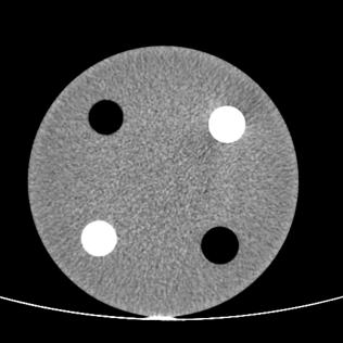 2 Imagem obtidas do módulo do Phantom utilizado para avaliação de linearidade do número de CT e espessura de corte.