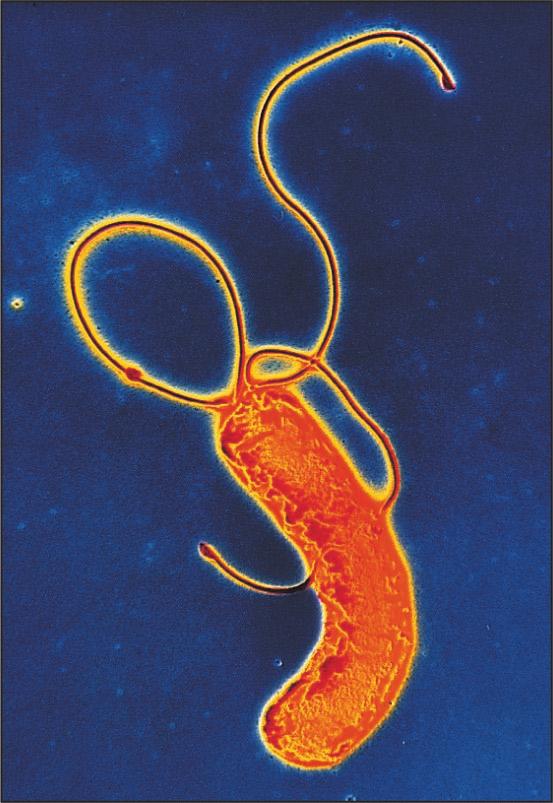 gonorrhea Escherichia coli comensal, gastroenterite
