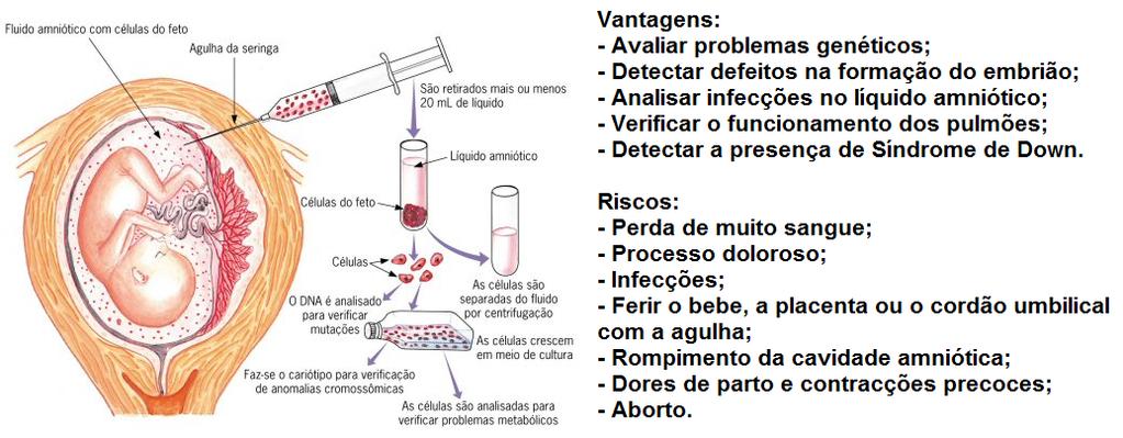 AMNIOCENTESE: Período: aproximadamente 16ª