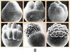 (UFJF) Após a segmentação do zigoto, inicia-se a gastrulação, onde ocorre a formação dos folhetos germinativos ou embrionários, do arquêntero e do blastóporo.