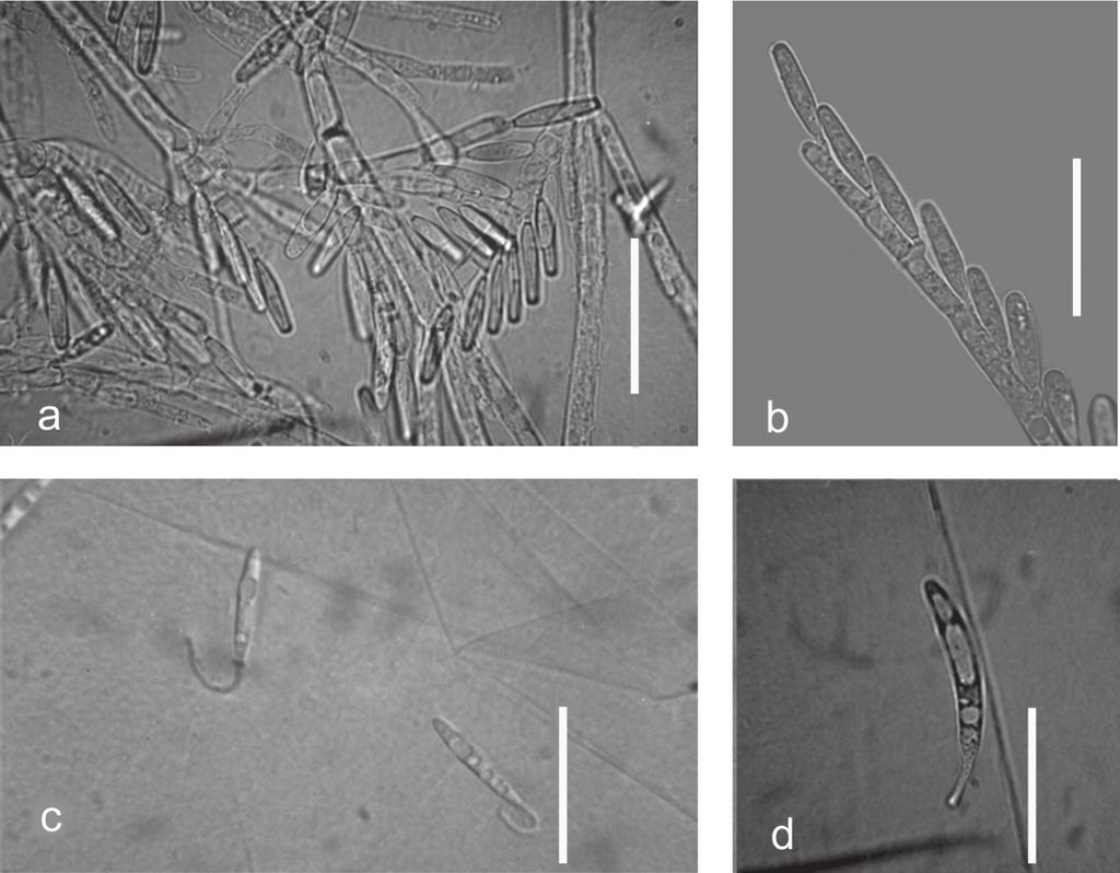 328 Trichomycete Fungi (Zygomycota) Associated with Mosquito Larvae (Diptera:... Pereira et al. Figure 1. S. culisetae (Trichomycetes: Harpellales).