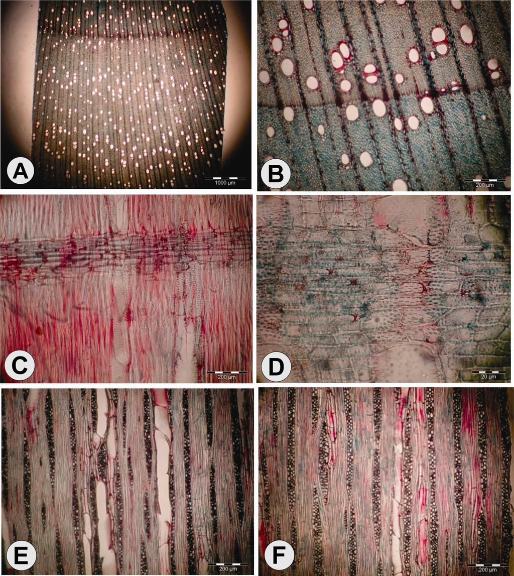 FIGURA 1. Fotomicrografias da madeira de Mimosa ramulosa Benth.