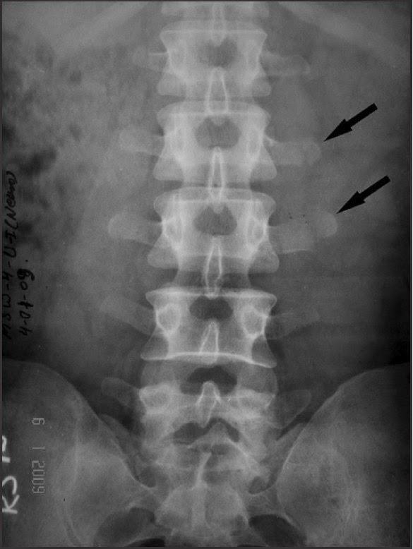 - ÓRGÃOS ABDOMINAIS E TECIDOS MOLES: Visualização depende do contraste existente entre estruturas contíguas.