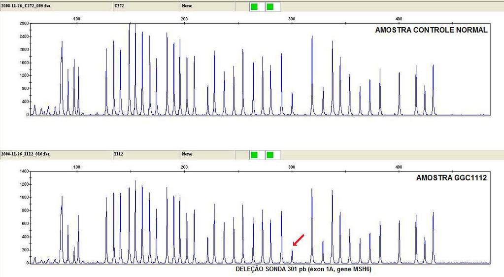 9.3. Resultados do Artigo 2 9.3.1. Eletroferogramas Figura 17. Eletroferogramas obtidos com o Software GeneMapper ID V3.