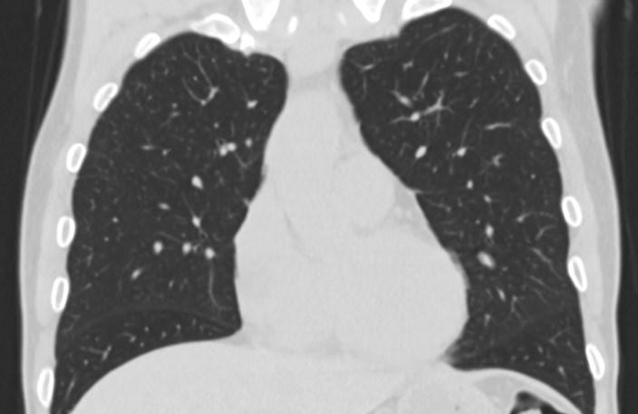 5. Faixa aorto-pulmonar Correlação com