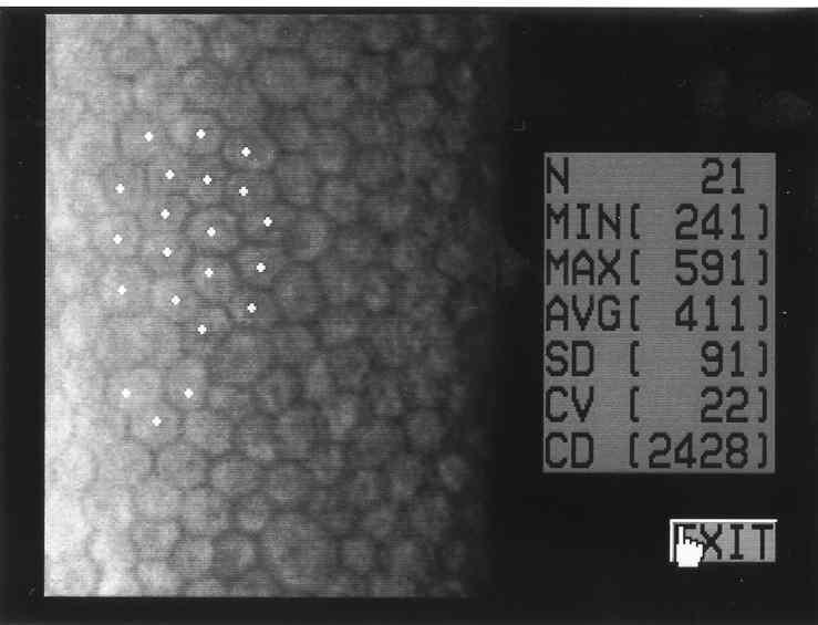 Mensurações de áreas celulares (µm 2 ) mínima (MIN) e máxima (MAX), sua média