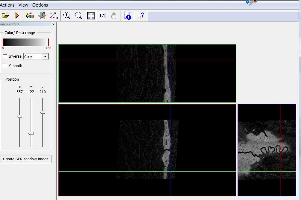 39 previamente armazenadas em solução fixadora de formaldeído a 10% para serem conservadas até a realização da microtomografia computadorizada no equipamento SkyScan 1172, Bruker, Belgium, Software