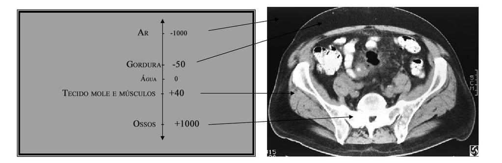 19 Fonte: Ebah ([201?]) Figura 2.3 - Diferentes densidades teciduais em HU A espessura do corte tomográfico é dada pelo voxel (figura 2.