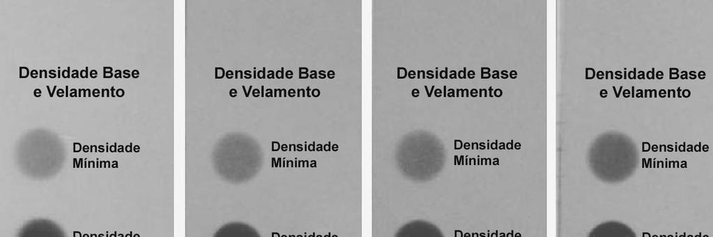 47 Figura 5 - Tiras de filmes expostos padronizadamente nas temperaturas indicadas, que foram usadas na avaliação do processamento radiográfico. 4.1.