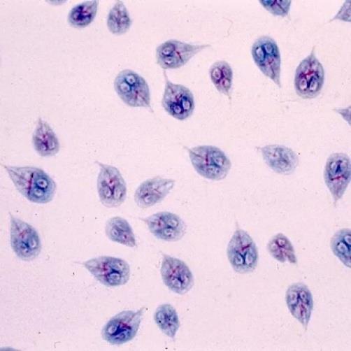 Figura 1. A- Trofozoítos de Giardia spp. Corados com tricrómio (ampliação de 40x). Figura 1. B- Cisto de Giardia spp. (ampliação de 40x). Fonte: SERRANO, 20