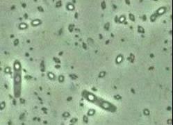 2.3 Aspectos Biológicos de Bacillus thuringiensis Bacillus thuringiensis é uma espécie bacteriana de solo, que reage positivamente para a coloração de Gram, flagelada, pertence à família Bacillaceae,