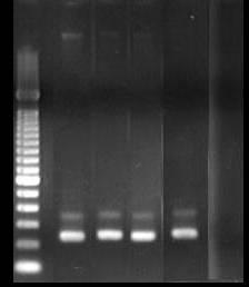 pb 1 2 3 4 5 6 Figura 22. Produtos de PCR obtidos com primers específicos para genes tipo cry1aa, por meio dos primers CJ1/CJ2.