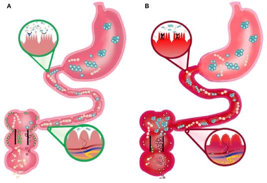 Cérebro - Intestino (A) Robust Gut: the healthy gut (B) Fragile Gut: the fragile gut of