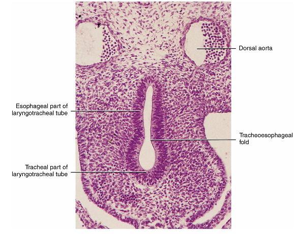 Desenvolvimento da laringe - Origina-se do endoderme da extremidade cefálica do