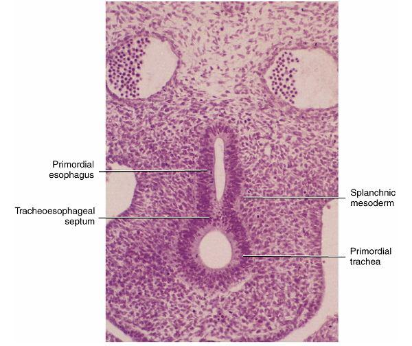 faríngeos 13 14 Desenvolvimento da traquéia - Origina-se do endoderme do tubo