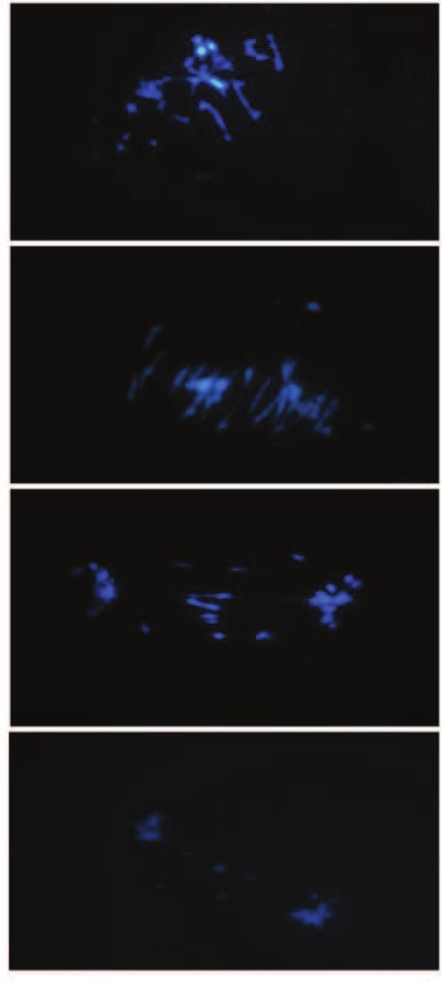 55 A A1 B B1 C C1 D D1 Figura 3 Hibridização in situ utilizando sondas de DNAr 45S no híbrido cultivar Paraíso Nota: Cromossomos adiantados na