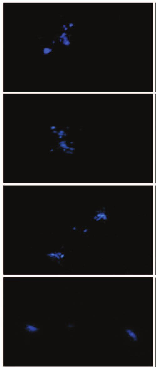 56 A A1 B B1 C C1 D D1 Figura 4 Nota: Hibridização in situ utilizando sondas de DNAr 45S no híbrido PCM0702-30 Cromossomos adiantados na metáfase I