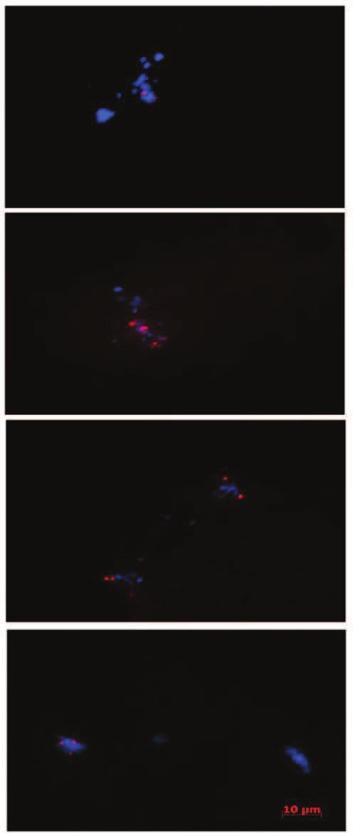 número de sinais; Cromossomos atrasados na anáfase I (C), cromossomos com sinal da sonda (C1) evidenciando sequencias de DNAr 45S em cromossomos em