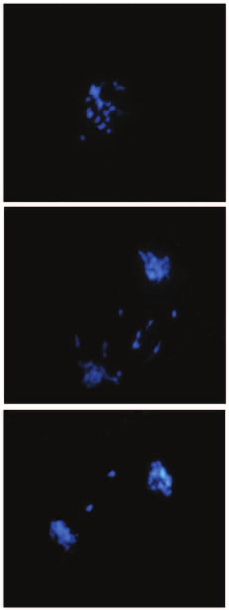 59 A A1 B B1 C C1 Figura 6 Hibridização in situ genômica no híbrido hexaploide PCM0702-30: Cromossomos adiantados na