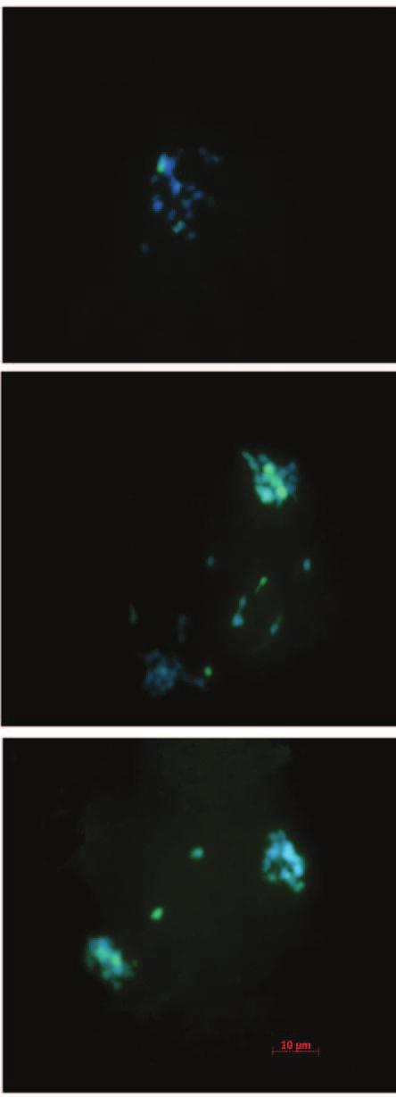 Cromossomos perdidos na telófase I (C), sinal da sonda (C1).