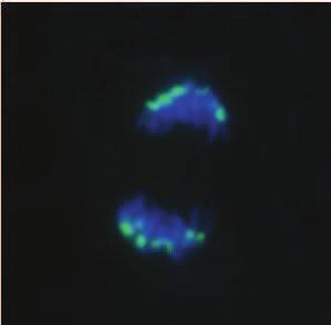 A1 a E1: Cromossomos com sinal