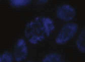 serina 10 (H3S10f) durante a mitose no