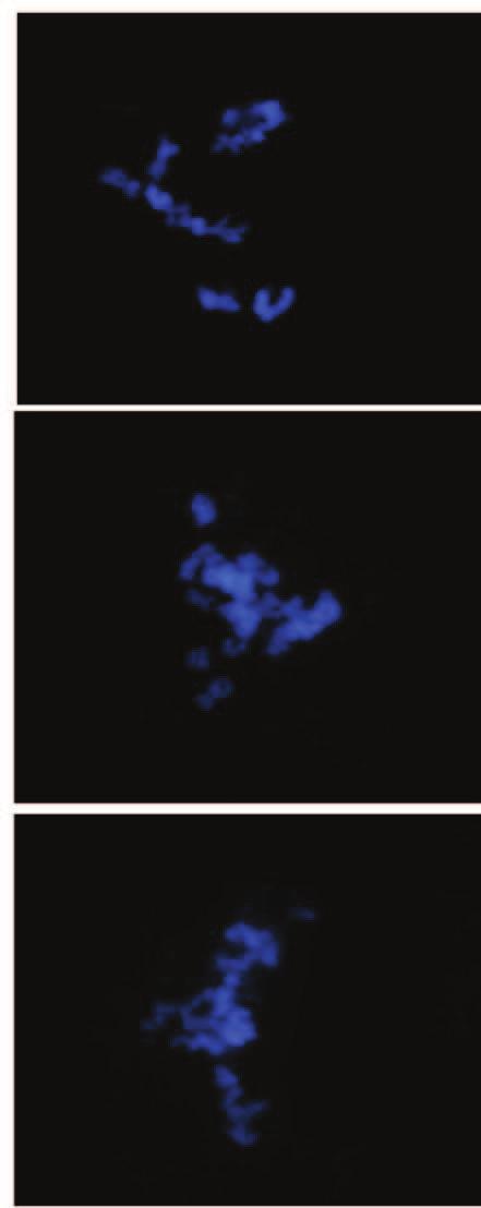 87 A A1 B B1 C C1 Figura 6 Imunodetecção da histona H3 fosforilada na serina 10 (H3S10f) durante a diacinese (A e B) e metáfase I (C) no genótipo hexaploide PCM 0702-03 Nota: (A e B) Observação no