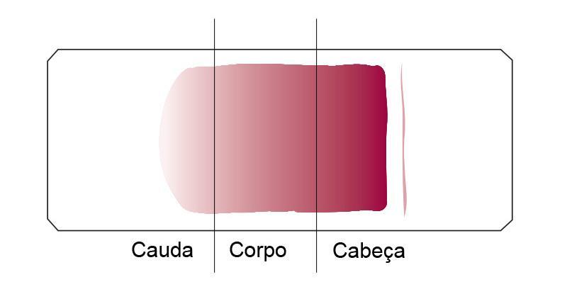 leucócitos (principalmente maior número de linfócitos). A cauda é a região final da distensão sanguínea.