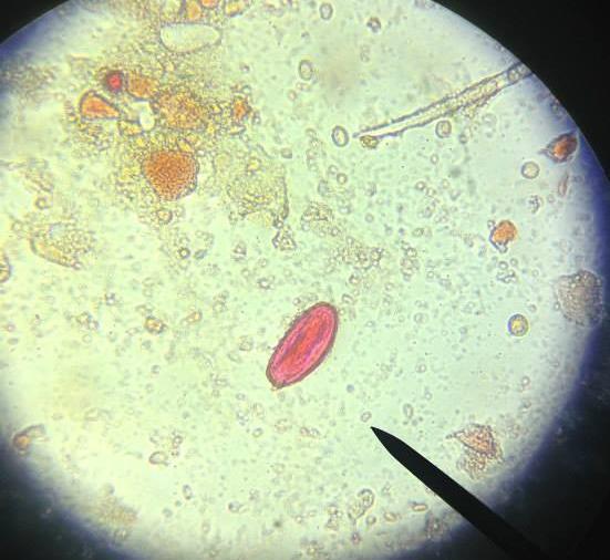 Enterobius vermicularis comum em crianças de 5 a 15 anos Ovos