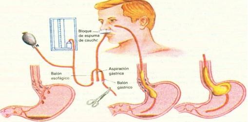 1 Exames do Sistema Digestório Endoscopia (Esofagoscopia e Gastroscopia): Visualização do esôfago, estômago e duodeno através de um aparelho chamado de endoscópio.