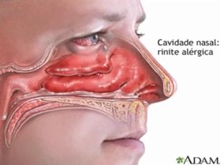 Hipotensão arterial: diminuição da pressão arterial. Hipertensão arterial: aumento do valor da pressão arterial. Bradicardia: frequência cardíaca abaixo do normal.