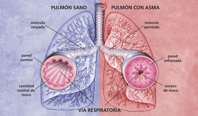 Hidratação oral; Assistência específica a pacientes que vão se submeter á cirurgia pulmonar, (vide enfermagem cirúrgica).