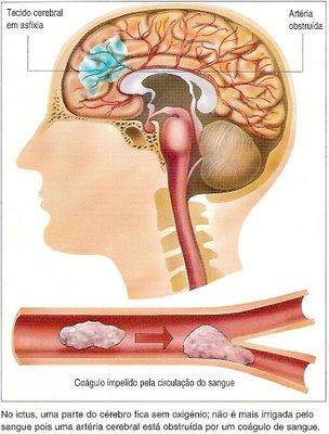 Disúria: dificuldade e/ou ardor para urinar. Hematúria: urina com sangue Piúria: urina com pus. Glicosúria: presença de glicose na urina. Colúria: presença de pigmentos biliares na urina.