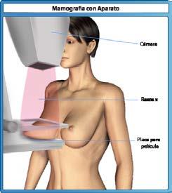 10 SISTEMA REPRODUTOR 10.1 Exames Mamografia: Exame radiológico das mamas para evidenciar presença de nódulos, cistos e tumores em geral. Não é necessário preparo para o exame.