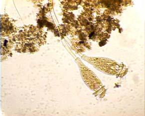 ciliados livres (protozoários do tipo Aspidisca cicada sp), que indica a