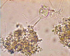 44- Flocos com prováveis colônias de bactérias nitrificantes