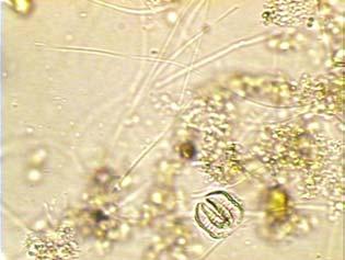 45 Flocos com Vorticella sp e organismos filamentos