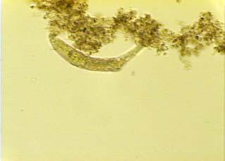 microbiológica, embora estivesse ainda muito aquém dos encontrados na etapa A.