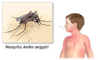 Sintomas: Dengue Clássico: Febre, dores no corpo, manchas avermelhadas e pequenos sangramentos.