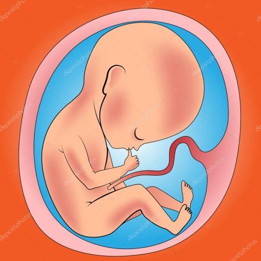 Legítima Defesa Merece destaque a situação do feto e do cadáver, que não são titulares de